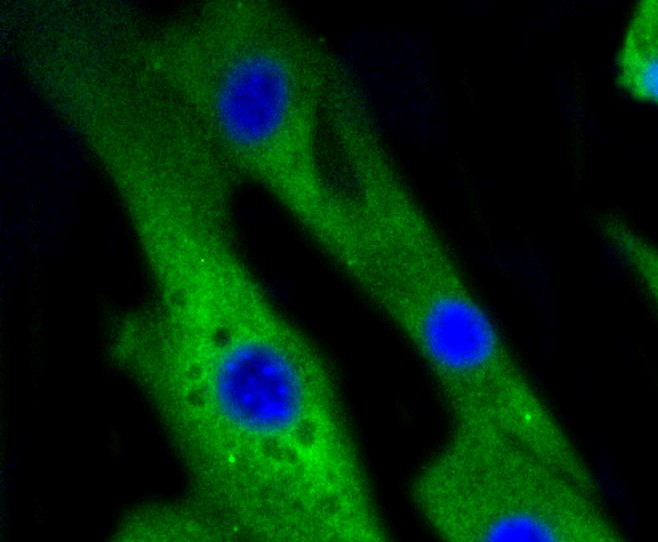 IF(ICC) staining with p38 (2H4) Monoclonal Antibody (bsm-52278R) at 1:100 in NIH/3T3 cells (green). The nuclear counterstain is DAPI (blue). Cells were fixed in paraformaldehyde, permeabilized with 0.25% Triton X100/PBS.