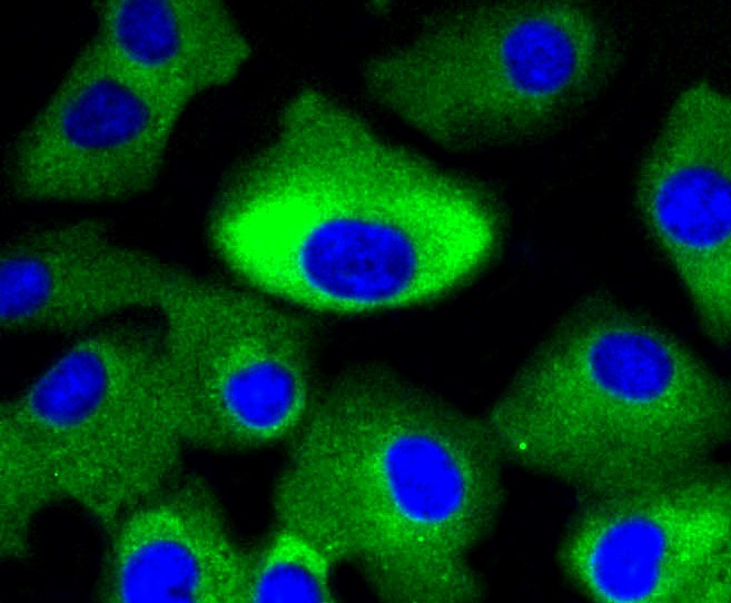 IF(ICC) staining with MAP2K1/2 (4H7) Monoclonal Antibody (bsm-52280R) at 1:100 in A549 cells (green). The nuclear counterstain is DAPI (blue). Cells were fixed in paraformaldehyde, permeabilized with 0.25% Triton X100/PBS.