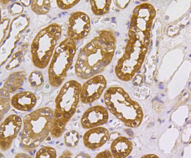 Paraformaldehyde-fixed and paraffin-embedded Human kidney tissue incubated with MAP2K1/2 (4H7) Monoclonal Antibody (bsm-52280R) at 1:100, overnight at 4°C, followed by a conjugated secondary antibody and DAB staining. Counterstained with hematoxylin.