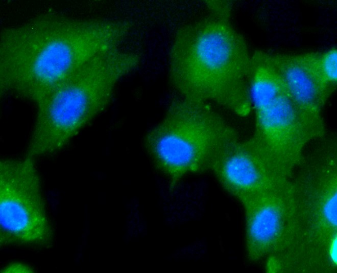 IF(ICC) staining with Caspase 2 (2B1) Monoclonal Antibody (bsm-52281R) at 1:100 in A549 cells (green). The nuclear counterstain is DAPI (blue). Cells were fixed in paraformaldehyde, permeabilized with 0.25% Triton X100/PBS.