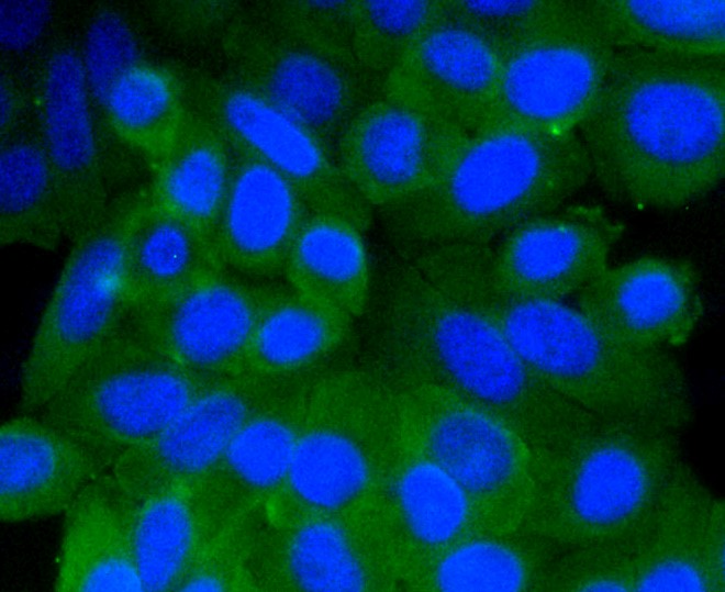 IF(ICC) staining with Prohibitin (1F10) Monoclonal Antibody (bsm-52282R) at 1:100 in HepG2 cells (green). The nuclear counterstain is DAPI (blue). Cells were fixed in paraformaldehyde, permeabilized with 0.25% Triton X100/PBS.