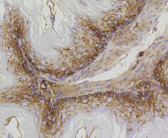 Paraformaldehyde-fixed and paraffin-embedded Mouse stomach tissue incubated with Prohibitin (1F10) Monoclonal Antibody (bsm-52282R) at 1:300, overnight at 4°C, followed by a conjugated secondary antibody and DAB staining. Counterstained with hematoxylin.