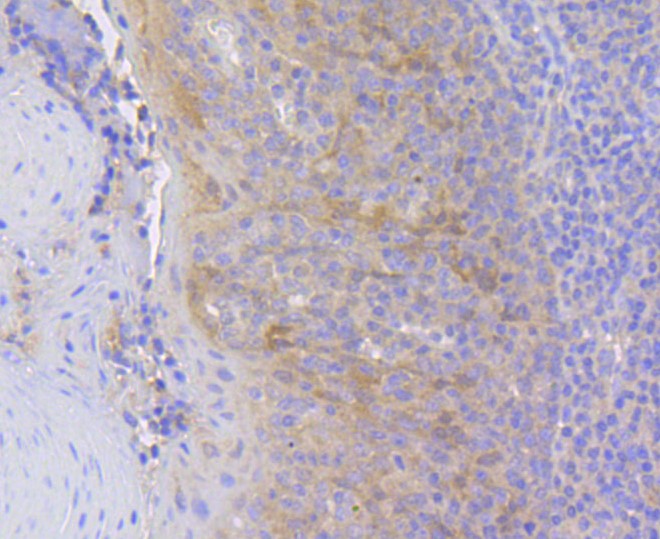 Paraformaldehyde-fixed and paraffin-embedded Human tonsil tissue incubated with HSPA8 (4D2) Monoclonal Antibody (bsm-52284R) at 1:100, overnight at 4°C, followed by a conjugated secondary antibody and DAB staining. Counterstained with hematoxylin.