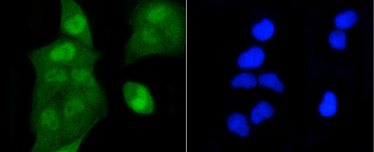 IF(ICC) staining with Histone H2A (acetyl K9) (4G2) Monoclonal Antibody (bsm-52285R) at 1:100 in HeLa cells (green). The nuclear counterstain is DAPI (blue). Cells were fixed in paraformaldehyde, permeabilized with 0.25% Triton X100/PBS.