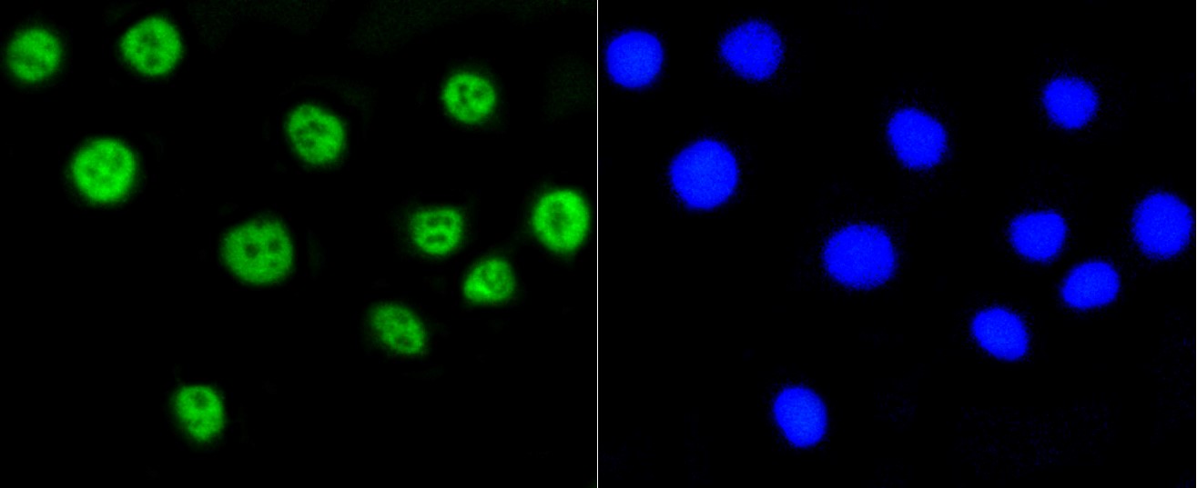 IF(ICC) staining with Histone H2A (acetyl K9) (4G2) Monoclonal Antibody (bsm-52285R) at 1:100 in A549 cells (green). The nuclear counterstain is DAPI (blue). Cells were fixed in paraformaldehyde, permeabilized with 0.25% Triton X100/PBS.