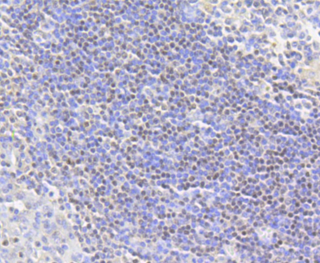 Paraformaldehyde-fixed and paraffin-embedded Human tonsil tissue incubated with Histone H2A (acetyl K9) (4G2) Monoclonal Antibody (bsm-52285R) at 1:100, overnight at 4°C, followed by a conjugated secondary antibody and DAB staining. Counterstained with hematoxylin.