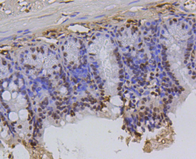 Paraformaldehyde-fixed and paraffin-embedded Mouse colon tissue incubated with Histone H2A (hydroxyl Y39) (2A3) Monoclonal Antibody (bsm-52286R) at 1:100, overnight at 4°C, followed by a conjugated secondary antibody and DAB staining. Counterstained with hematoxylin.