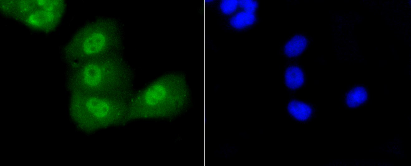 IF(ICC) staining with p53(acetyl K370) (2F1) Monoclonal Antibody (bsm-52288R) at 1:100 in PANC-1 cells (green). The nuclear counterstain is DAPI (blue). Cells were fixed in paraformaldehyde, permeabilized with 0.25% Triton X100/PBS.