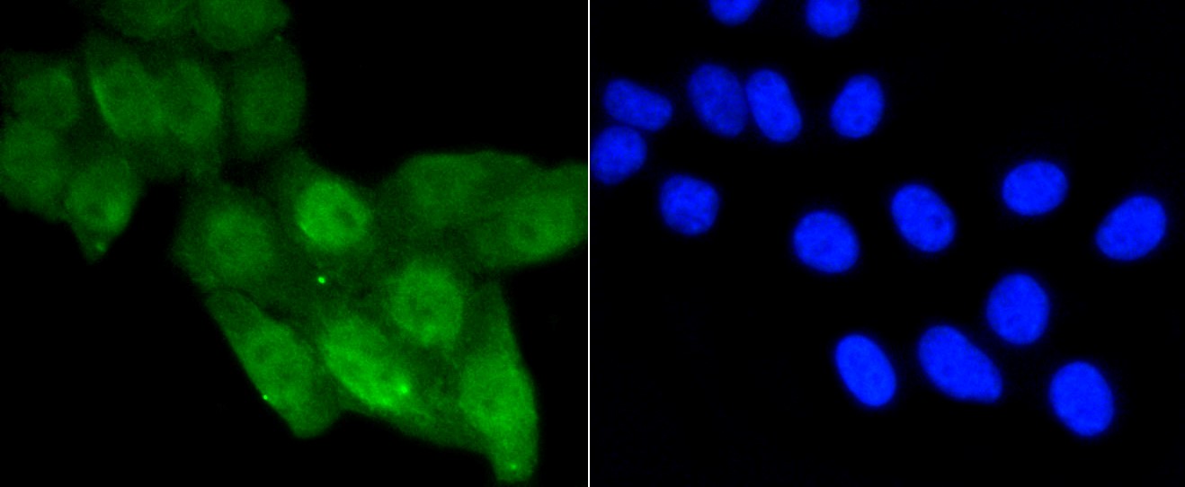 IF(ICC) staining with p53(acetyl K370) (2F1) Monoclonal Antibody (bsm-52288R) at 1:100 in HepG2 cells (green). The nuclear counterstain is DAPI (blue). Cells were fixed in paraformaldehyde, permeabilized with 0.25% Triton X100/PBS.