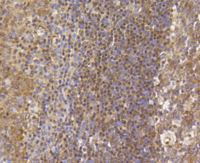 Paraformaldehyde-fixed and paraffin-embedded Human tonsil tissue incubated with Histone H3 (mono+di+methyl K79) (2B11) Monoclonal Antibody (bsm-52291R) at 1:100, overnight at 4°C, followed by a conjugated secondary antibody and DAB staining. Counterstained with hematoxylin.