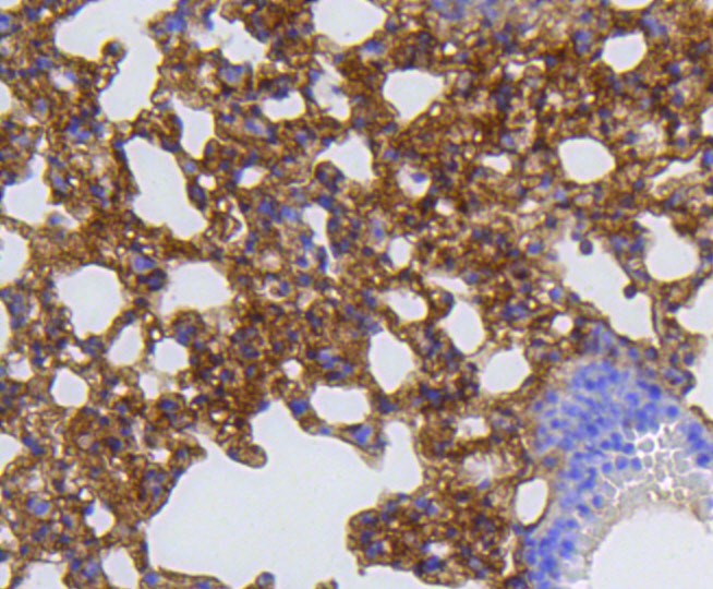 Paraformaldehyde-fixed and paraffin-embedded Mouse lung tissue incubated with MMP12 (1A4) Monoclonal Antibody (bsm-52292R) at 1:100, overnight at 4°C, followed by a conjugated secondary antibody and DAB staining. Counterstained with hematoxylin.