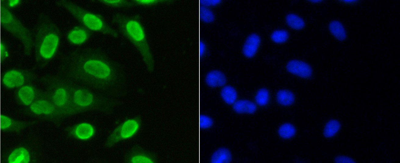 IF(ICC) staining with Histone H3(mono methyl K36) (6G6) Monoclonal Antibody (bsm-52298R) at 1:100 in MCF-7 cells (green). The nuclear counterstain is DAPI (blue). Cells were fixed in paraformaldehyde, permeabilized with 0.25% Triton X100/PBS.