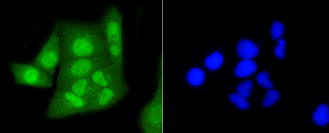 IF(ICC) staining with CBX5 (3G1) Monoclonal Antibody (bsm-52301R) at 1:100 in HeLa cells (green). The nuclear counterstain is DAPI (blue). Cells were fixed in paraformaldehyde, permeabilized with 0.25% Triton X100/PBS.