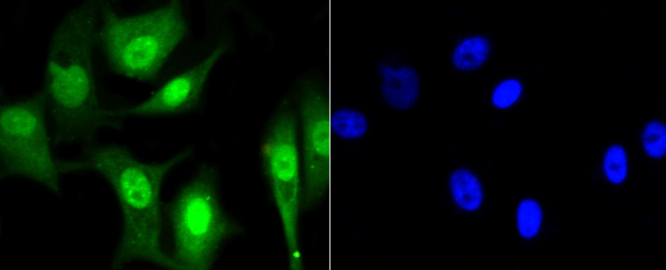 IF(ICC) staining with CBX5 (3G1) Monoclonal Antibody (bsm-52301R) at 1:100 in MCF-7 cells (green). The nuclear counterstain is DAPI (blue). Cells were fixed in paraformaldehyde, permeabilized with 0.25% Triton X100/PBS.