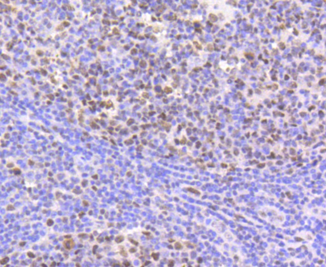 Paraformaldehyde-fixed and paraffin-embedded Human tonsil tissue incubated with CBX5 (3G1) Monoclonal Antibody (bsm-52301R) at 1:100, overnight at 4°C, followed by a conjugated secondary antibody and DAB staining. Counterstained with hematoxylin.