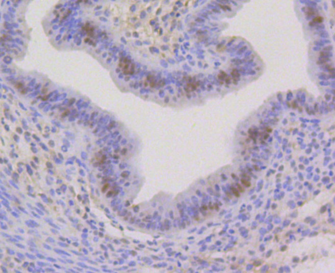 Paraformaldehyde-fixed and paraffin-embedded Mouse uterus tissue incubated with CBX5 (3G1) Monoclonal Antibody (bsm-52301R) at 1:100, overnight at 4°C, followed by a conjugated secondary antibody and DAB staining. Counterstained with hematoxylin.