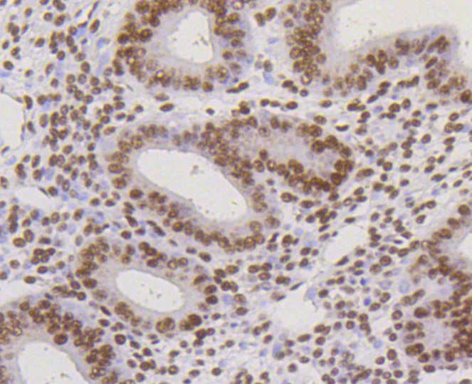 Paraformaldehyde-fixed and paraffin-embedded Human uterus tissue incubated with CBX5 (3G1) Monoclonal Antibody (bsm-52301R) at 1:100, overnight at 4°C, followed by a conjugated secondary antibody and DAB staining. Counterstained with hematoxylin.