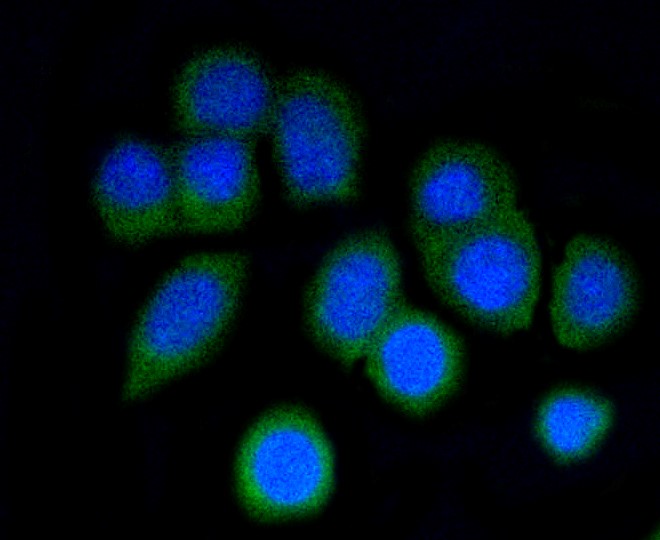 IF(ICC) staining with p16 ARC (8D8) Monoclonal Antibody (bsm-52302R) at 1:50 in N2A cells (green). The nuclear counterstain is DAPI (blue). Cells were fixed in paraformaldehyde, permeabilized with 0.25% Triton X100/PBS.