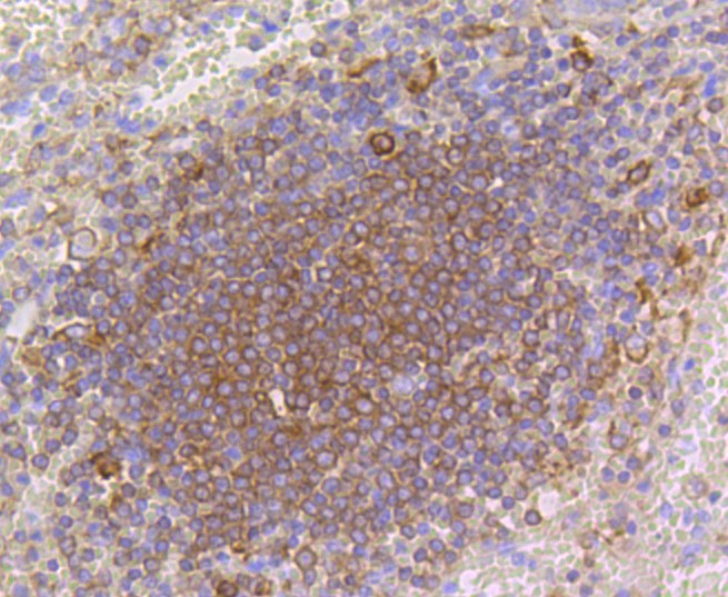 Paraformaldehyde-fixed and paraffin-embedded Human spleen tissue incubated with p16 ARC (8D8) Monoclonal Antibody (bsm-52302R) at 1:100, overnight at 4°C, followed by a conjugated secondary antibody and DAB staining. Counterstained with hematoxylin.