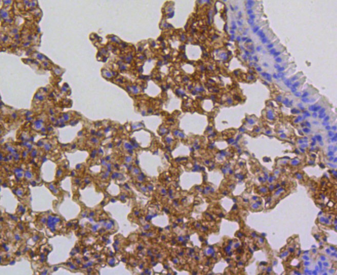 Paraformaldehyde-fixed and paraffin-embedded Mouse lung tissue incubated with p16 ARC (8D8) Monoclonal Antibody (bsm-52302R) at 1:100, overnight at 4°C, followed by a conjugated secondary antibody and DAB staining. Counterstained with hematoxylin.