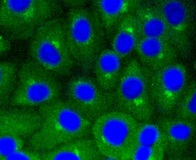 IF(ICC) staining with Caveolin-1 (9C11) Monoclonal Antibody (bsm-52303R) at 1:100 in A549 cells (green). The nuclear counterstain is DAPI (blue). Cells were fixed in paraformaldehyde, permeabilized with 0.25% Triton X100/PBS.