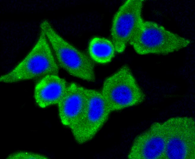 IF(ICC) staining with Caveolin-1 (9C11) Monoclonal Antibody (bsm-52303R) at 1:100 in MCF-7 cells (green). The nuclear counterstain is DAPI (blue). Cells were fixed in paraformaldehyde, permeabilized with 0.25% Triton X100/PBS.