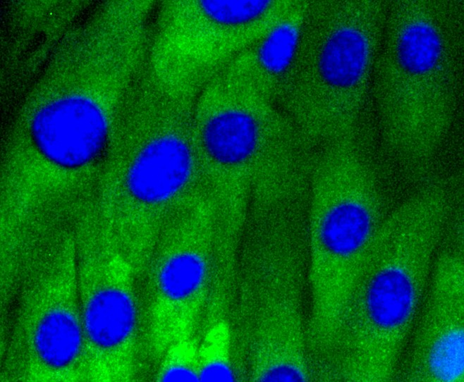 IF(ICC) staining with Caveolin-1 (9C11) Monoclonal Antibody (bsm-52303R) at 1:100 in NIH/3T3 cells (green). The nuclear counterstain is DAPI (blue). Cells were fixed in paraformaldehyde, permeabilized with 0.25% Triton X100/PBS.