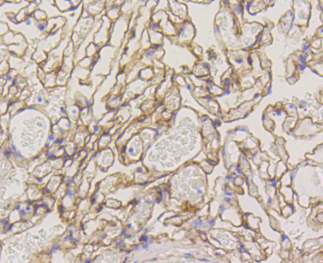 Paraformaldehyde-fixed and paraffin-embedded Human lung tissue incubated with Caveolin-1 (9C11) Monoclonal Antibody (bsm-52303R) at 1:100, overnight at 4°C, followed by a conjugated secondary antibody and DAB staining. Counterstained with hematoxylin.