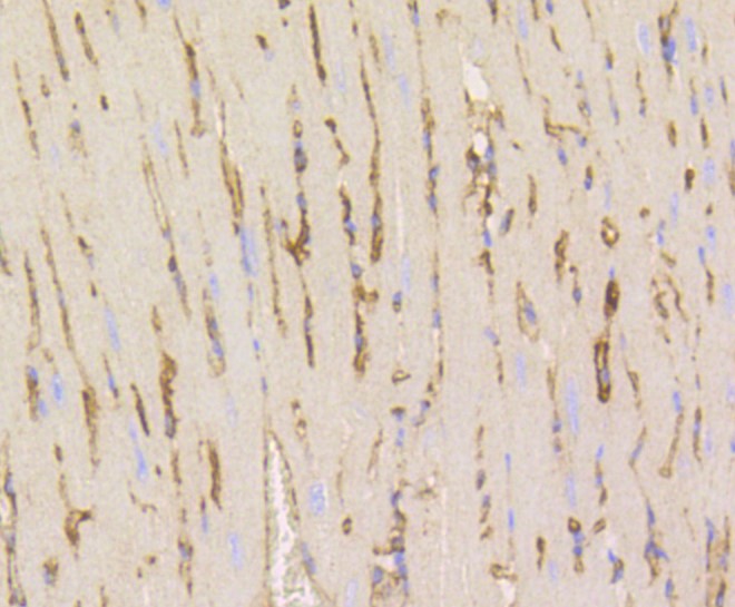 Paraformaldehyde-fixed and paraffin-embedded Mouse heart tissue incubated with Caveolin-1 (9C11) Monoclonal Antibody (bsm-52303R) at 1:100, overnight at 4°C, followed by a conjugated secondary antibody and DAB staining. Counterstained with hematoxylin.
