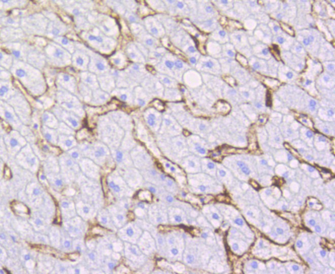 Paraformaldehyde-fixed and paraffin-embedded Human liver tissue incubated with Caveolin-1 (9C11) Monoclonal Antibody (bsm-52303R) at 1:100, overnight at 4°C, followed by a conjugated secondary antibody and DAB staining. Counterstained with hematoxylin.
