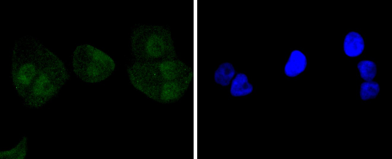 IF(ICC) staining with Caspase-8 (8D6) Monoclonal Antibody (bsm-52308R) at 1:100 in HeLa cells (green). The nuclear counterstain is DAPI (blue). Cells were fixed in paraformaldehyde, permeabilized with 0.25% Triton X100/PBS.