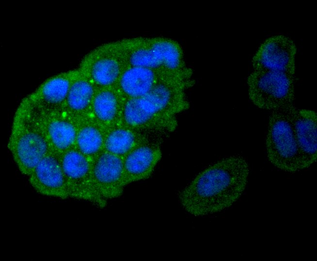 IF(ICC) staining with Caspase-8 (8D6) Monoclonal Antibody (bsm-52308R) at 1:100 in MCF-7 cells (green). The nuclear counterstain is DAPI (blue). Cells were fixed in paraformaldehyde, permeabilized with 0.25% Triton X100/PBS.