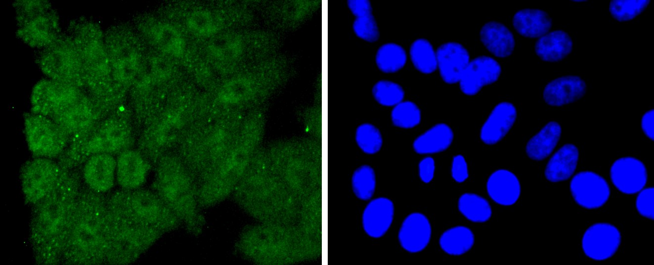 IF(ICC) staining with Caspase-8 (8D6) Monoclonal Antibody (bsm-52308R) at 1:100 in HepG2 cells (green). The nuclear counterstain is DAPI (blue). Cells were fixed in paraformaldehyde, permeabilized with 0.25% Triton X100/PBS.