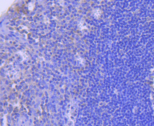 Paraformaldehyde-fixed and paraffin-embedded Human tonsil tissue incubated with Caspase-8 (8D6) Monoclonal Antibody (bsm-52308R) at 1:100, overnight at 4°C, followed by a conjugated secondary antibody and DAB staining. Counterstained with hematoxylin.