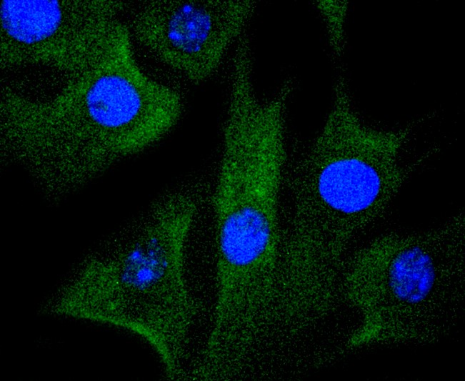 IF(ICC) staining with MAP2K1 (7D8) Monoclonal Antibody (bsm-52311R) at 1:100 in NIH/3T3 cells (green). The nuclear counterstain is DAPI (blue). Cells were fixed in paraformaldehyde, permeabilized with 0.25% Triton X100/PBS.