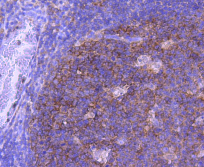 Paraformaldehyde-fixed and paraffin-embedded Human tonsil tissue incubated with MAP2K1 (7D8) Monoclonal Antibody (bsm-52311R) at 1:100, overnight at 4°C, followed by a conjugated secondary antibody and DAB staining. Counterstained with hematoxylin.