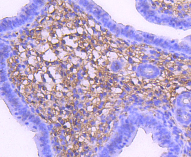 Paraformaldehyde-fixed and paraffin-embedded Mouse uterus tissue incubated with MAP2K1 (7D8) Monoclonal Antibody (bsm-52311R) at 1:100, overnight at 4°C, followed by a conjugated secondary antibody and DAB staining. Counterstained with hematoxylin.