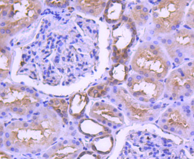 Paraformaldehyde-fixed and paraffin-embedded Human kidney tissue incubated with MAP2K1 (7D8) Monoclonal Antibody (bsm-52311R) at 1:100, overnight at 4°C, followed by a conjugated secondary antibody and DAB staining. Counterstained with hematoxylin.