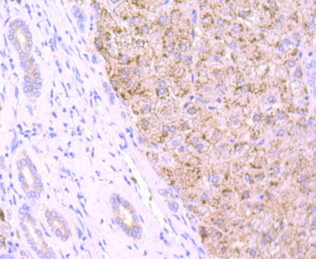 Paraformaldehyde-fixed and paraffin-embedded Human liver tissue incubated with Cathepsin B (3C9) Monoclonal Antibody (bsm-52977R) at 1:100, overnight at 4°C, followed by a conjugated secondary antibody and DAB staining. Counterstained with hematoxylin.