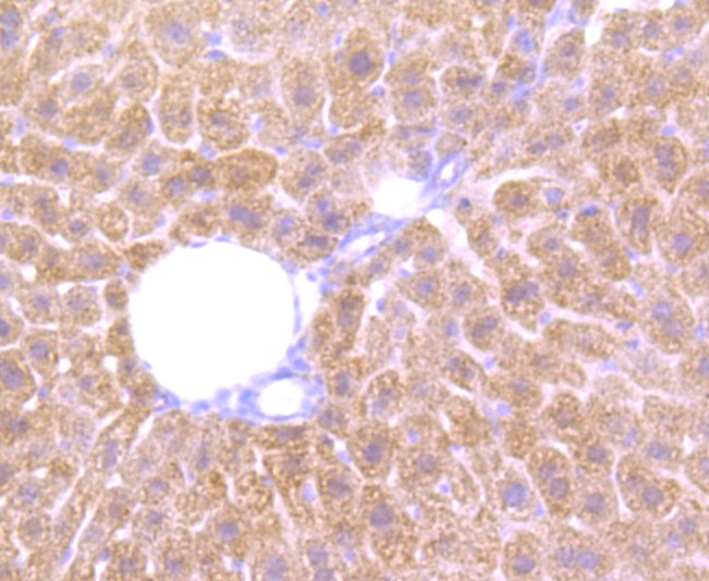 Paraformaldehyde-fixed and paraffin-embedded Mouse liver tissue incubated with Cathepsin B (3C9) Monoclonal Antibody (bsm-52977R) at 1:100, overnight at 4°C, followed by a conjugated secondary antibody and DAB staining. Counterstained with hematoxylin.