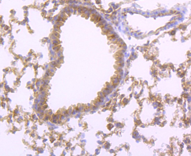 Paraformaldehyde-fixed and paraffin-embedded Mouse lung tissue incubated with FABP4 (7C4) Monoclonal Antibody (bsm-52973R) at 1:100, overnight at 4°C, followed by a conjugated secondary antibody and DAB staining. Counterstained with hematoxylin.