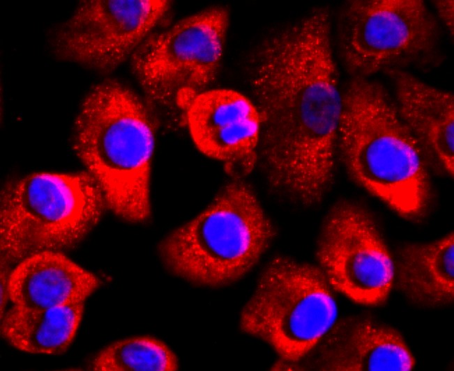 IF(ICC) staining with FABP4 (7C4) Monoclonal Antibody (bsm-52973R) at 1:200 in A549 cells (red). The nuclear counterstain is DAPI (blue). Cells were fixed in paraformaldehyde, permeabilized with 0.25% Triton X100/PBS.