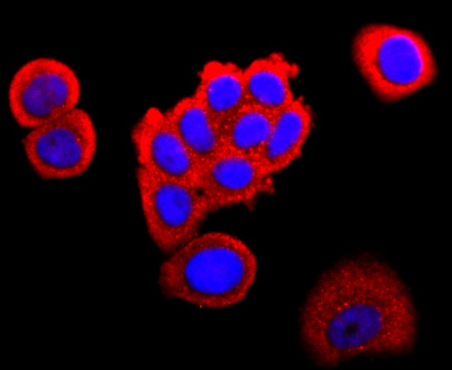 IF(ICC) staining with FABP4 (7C4) Monoclonal Antibody (bsm-52973R) at 1:200 in MCF-7 cells (red). The nuclear counterstain is DAPI (blue). Cells were fixed in paraformaldehyde, permeabilized with 0.25% Triton X100/PBS.
