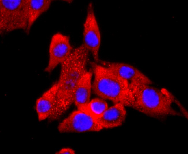 IF(ICC) staining with FABP4 (7C4) Monoclonal Antibody (bsm-52973R) at 1:200 in PMVEC cells (red). The nuclear counterstain is DAPI (blue). Cells were fixed in paraformaldehyde, permeabilized with 0.25% Triton X100/PBS.