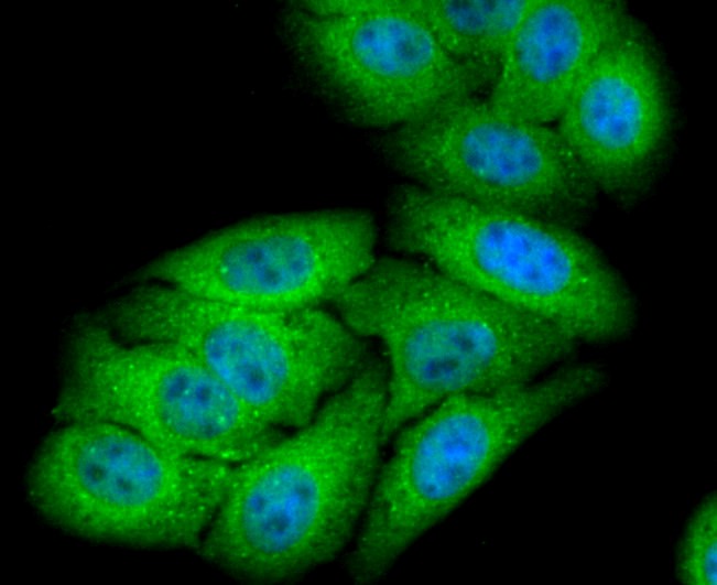 IF(ICC) staining with NUR77 (1C1) Monoclonal Antibody (bsm-52972R) at 1:100 in HepG2 cells (green). The nuclear counterstain is DAPI (blue). Cells were fixed in paraformaldehyde, permeabilized with 0.25% Triton X100/PBS.