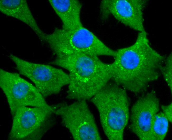 IF(ICC) staining with NUR77 (1C1) Monoclonal Antibody (bsm-52972R) at 1:100 in NIH-3T3 cells (green). The nuclear counterstain is DAPI (blue). Cells were fixed in paraformaldehyde, permeabilized with 0.25% Triton X100/PBS.