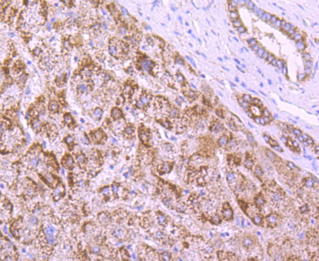 Paraformaldehyde-fixed and paraffin-embedded Human liver tissue incubated with NUR77 (1C1) Monoclonal Antibody (bsm-52972R) at 1:100, overnight at 4°C, followed by a conjugated secondary antibody and DAB staining. Counterstained with hematoxylin.