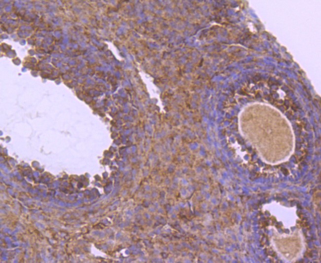 Paraformaldehyde-fixed and paraffin-embedded Mouse ovarian tissue incubated with NUR77 (1C1) Monoclonal Antibody (bsm-52972R) at 1:100, overnight at 4°C, followed by a conjugated secondary antibody and DAB staining. Counterstained with hematoxylin.