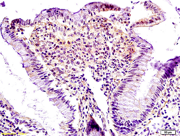 Formalin-fixed and paraffin embedded rat colon labeled with Anti Lpin1 Polyclonal Antibody, Unconjugated (bs-0759R) at 1:200 followed by conjugation to the secondary antibody and DAB staining.