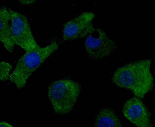 IF(ICC) staining with MMP17 (8C8) Monoclonal Antibody (bsm-54233R) at 1:100 in A549 cells (green). The nuclear counterstain is DAPI (blue). Cells were fixed in paraformaldehyde, permeabilized with 0.25% Triton X100/PBS. IF(ICC) staining with MMP17 (8C8) Monoclonal Antibody (bsm-54233R) at 1:100 in A549 cells (green). The nuclear counterstain is DAPI (blue). Cells were fixed in paraformaldehyde, permeabilized with 0.25% Triton X100/PBS.